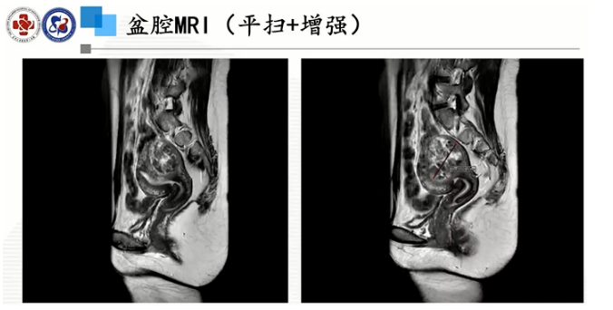 20230223450451.png image.png