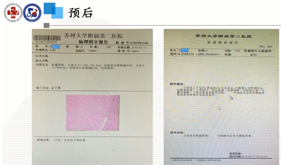 20230223878163.png image.png