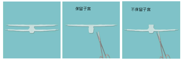 20220531358018.png image.png