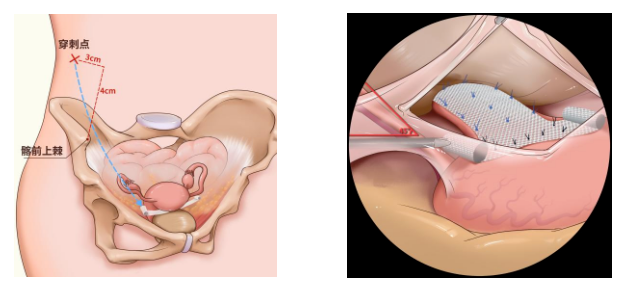 20220531692974.png image.png