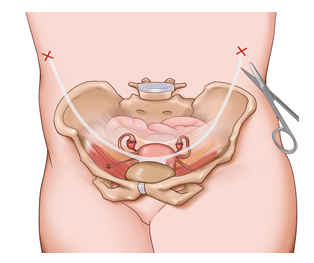 20220531712830.png image.png