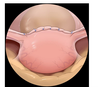 20220531733082.png image.png