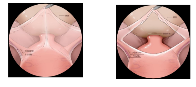 20220531857096.png image.png