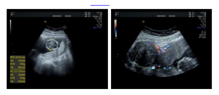 20221107137346.png image.png