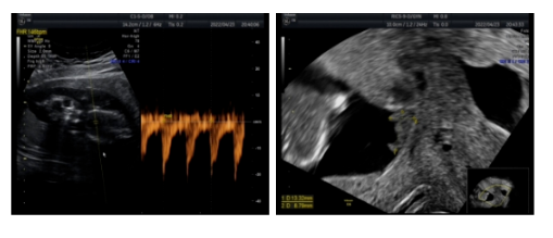 20221107179674.png image.png