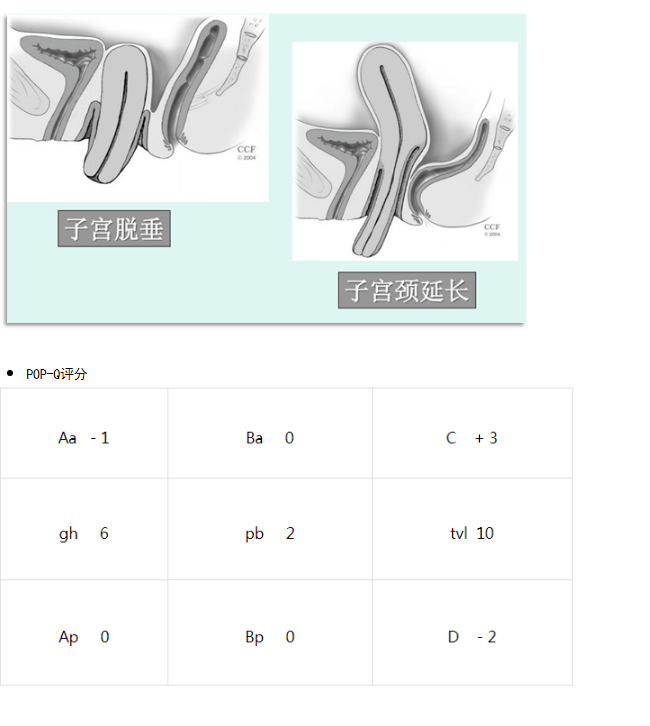 20221107451519.png image.png