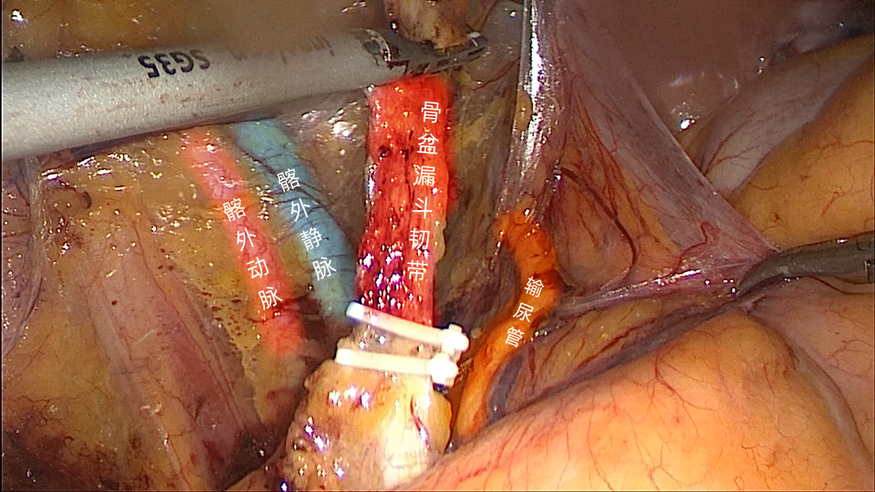 20230704151702.png 7.png