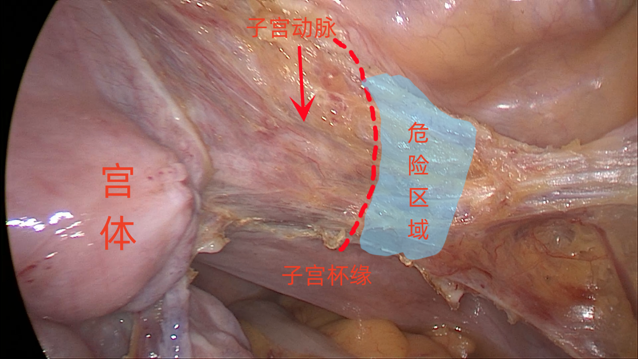 20230704254395.png 13.png