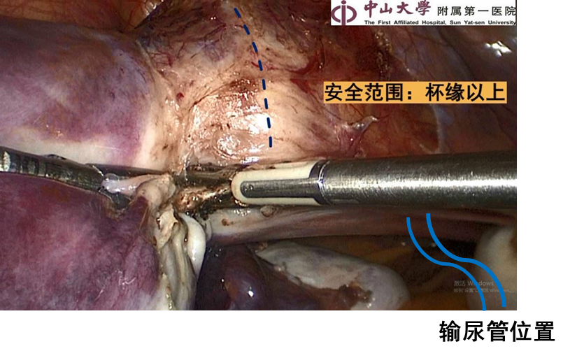 20230704277189.png 12.png