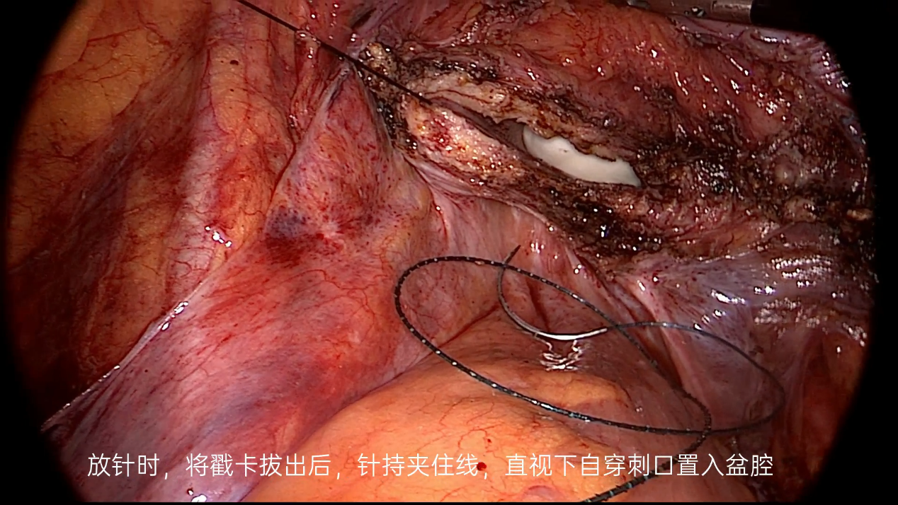 20230704359700.png 4.png