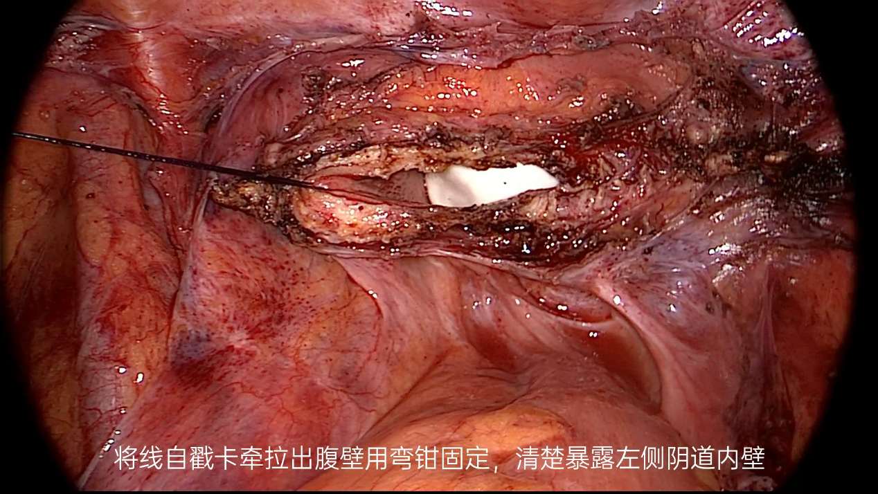 20230704369601.png 3.png