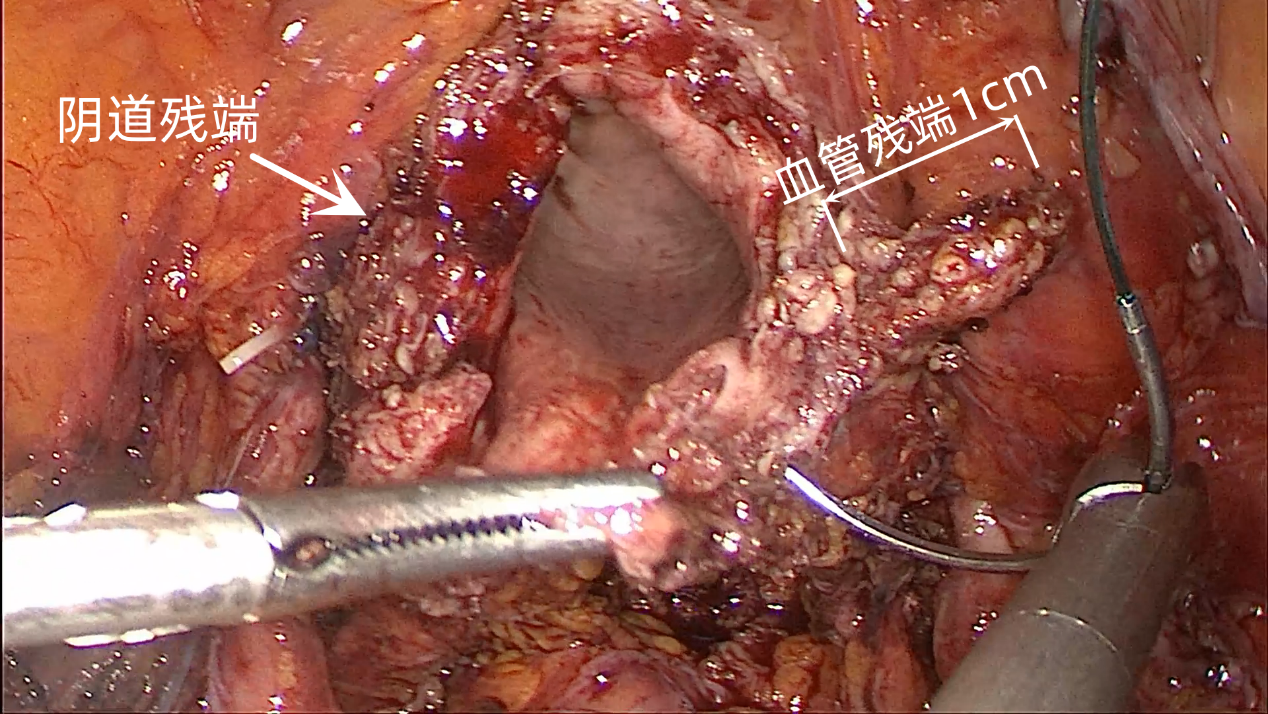 20230704431401.png 17.png