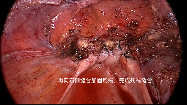 20230704526343.png 13.png