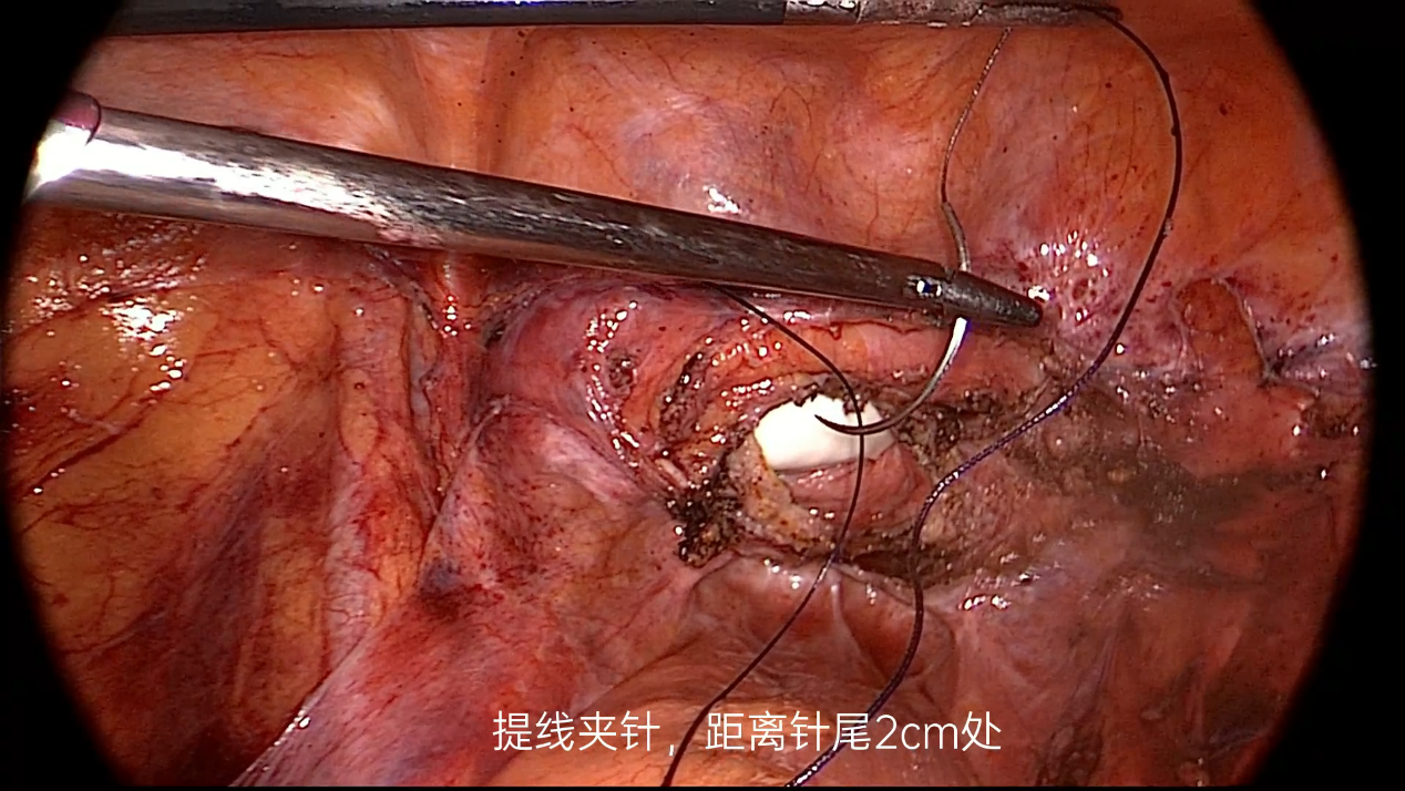 20230704536723.png 1.png