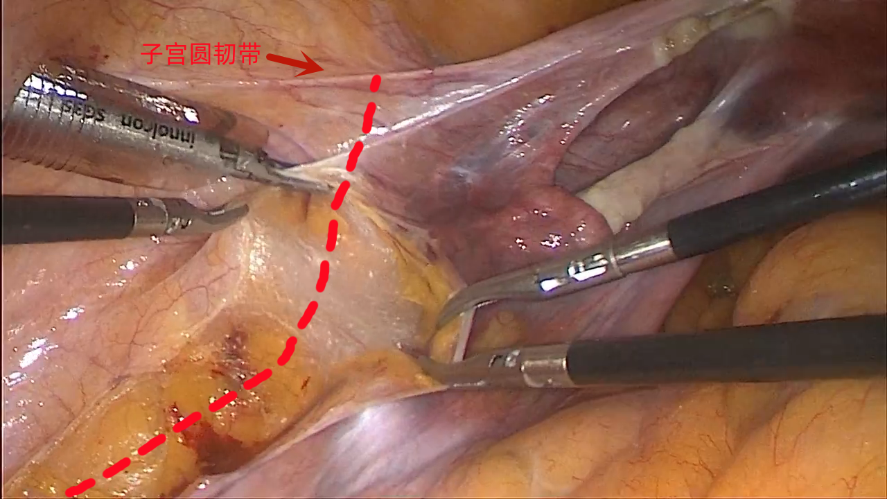 20230704588173.png 2.png