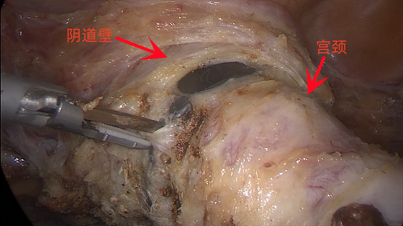 20230704607151.png 16.png