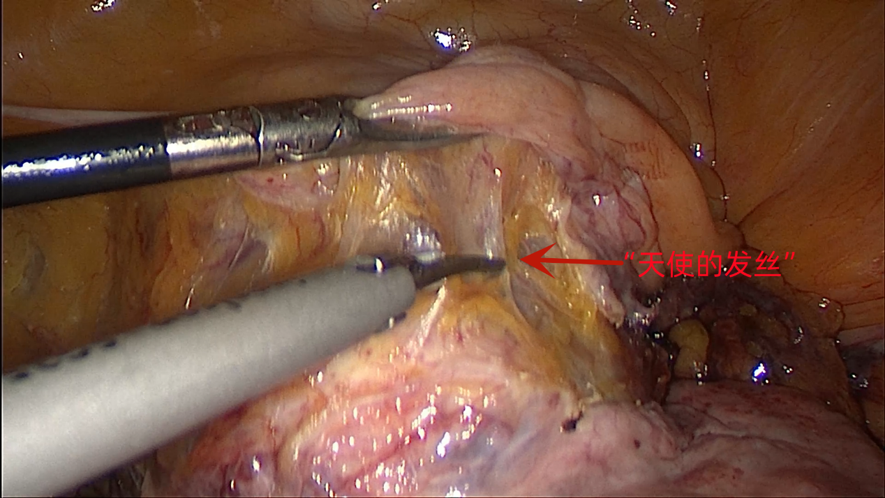 20230704616316.png 10.png