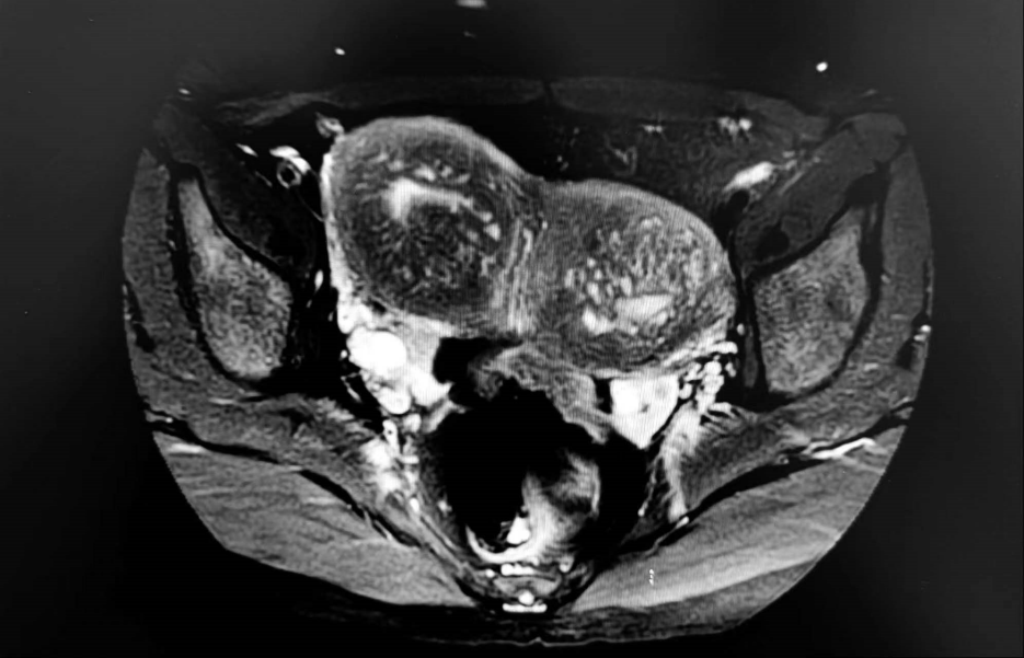 20230901823065.png 易.png