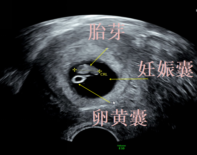 20260313575192.png WPS图片(1).png