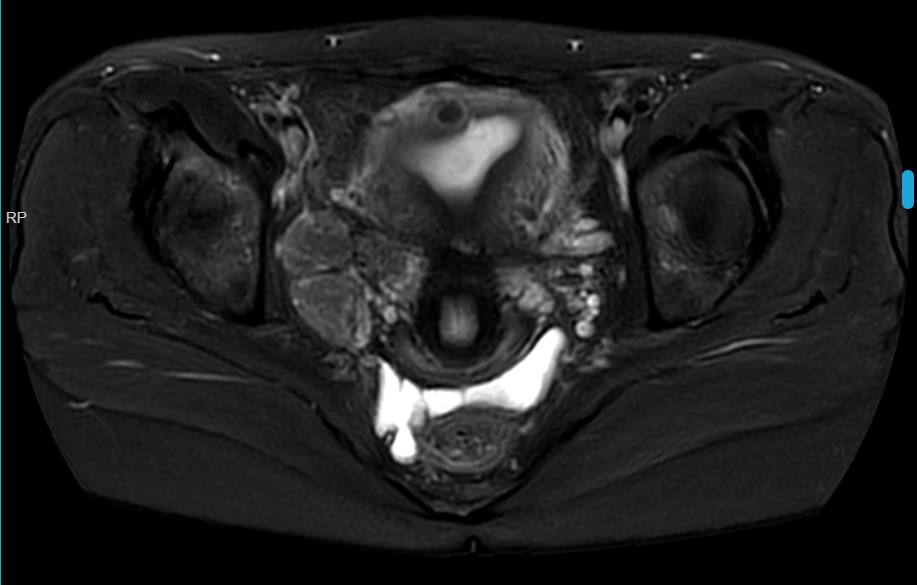 20260324165740.png 图片3.png